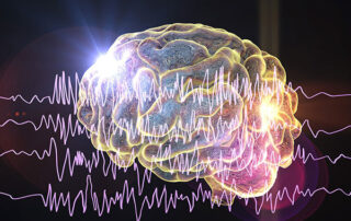 Epilepsy Management