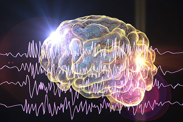 Epilepsy Management